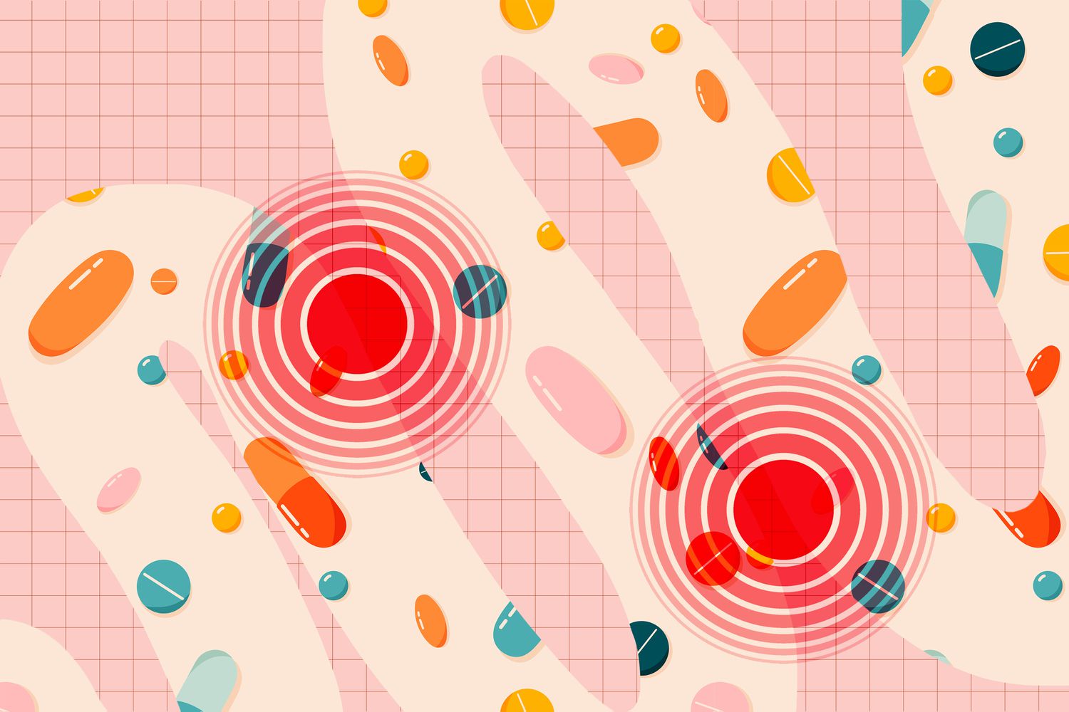 4 Supplements You Shouldn't Take for Gut Health
