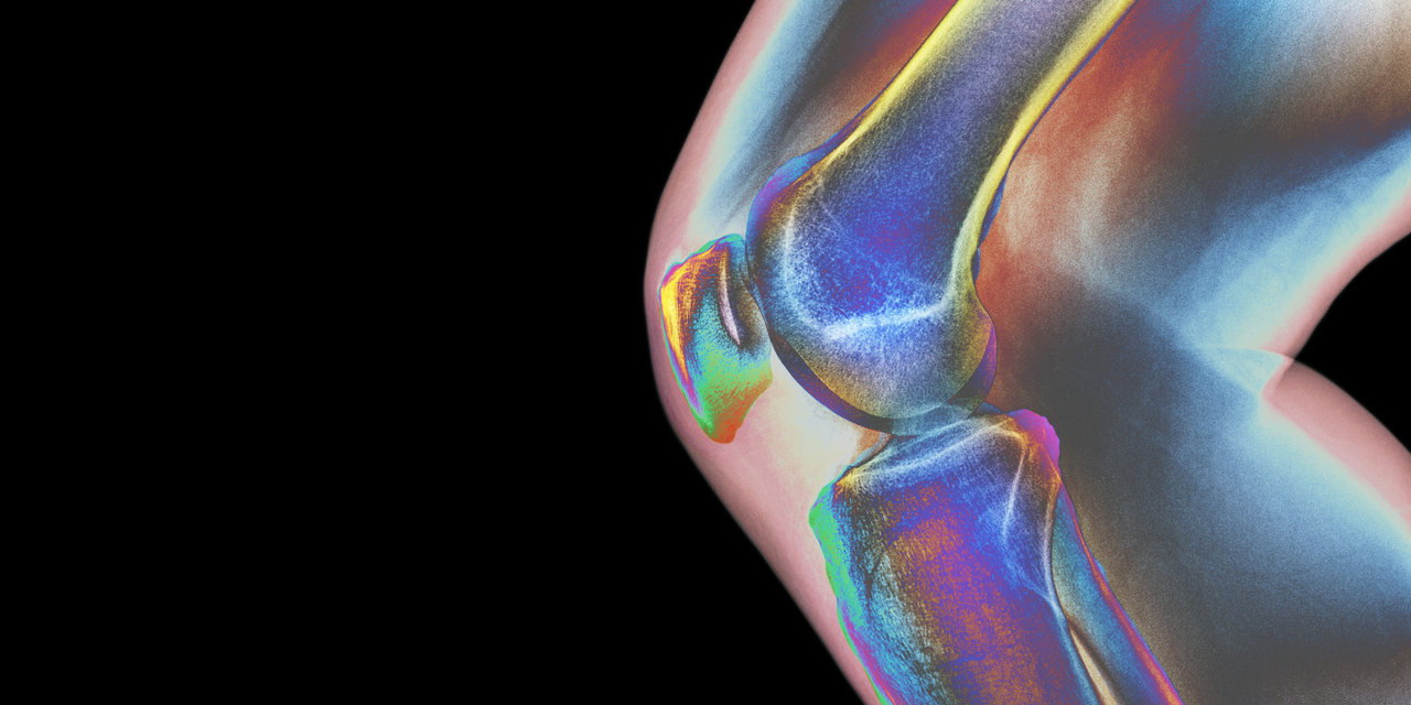 5 Things You Can Do Now to Prevent Osteoporosis in the Future