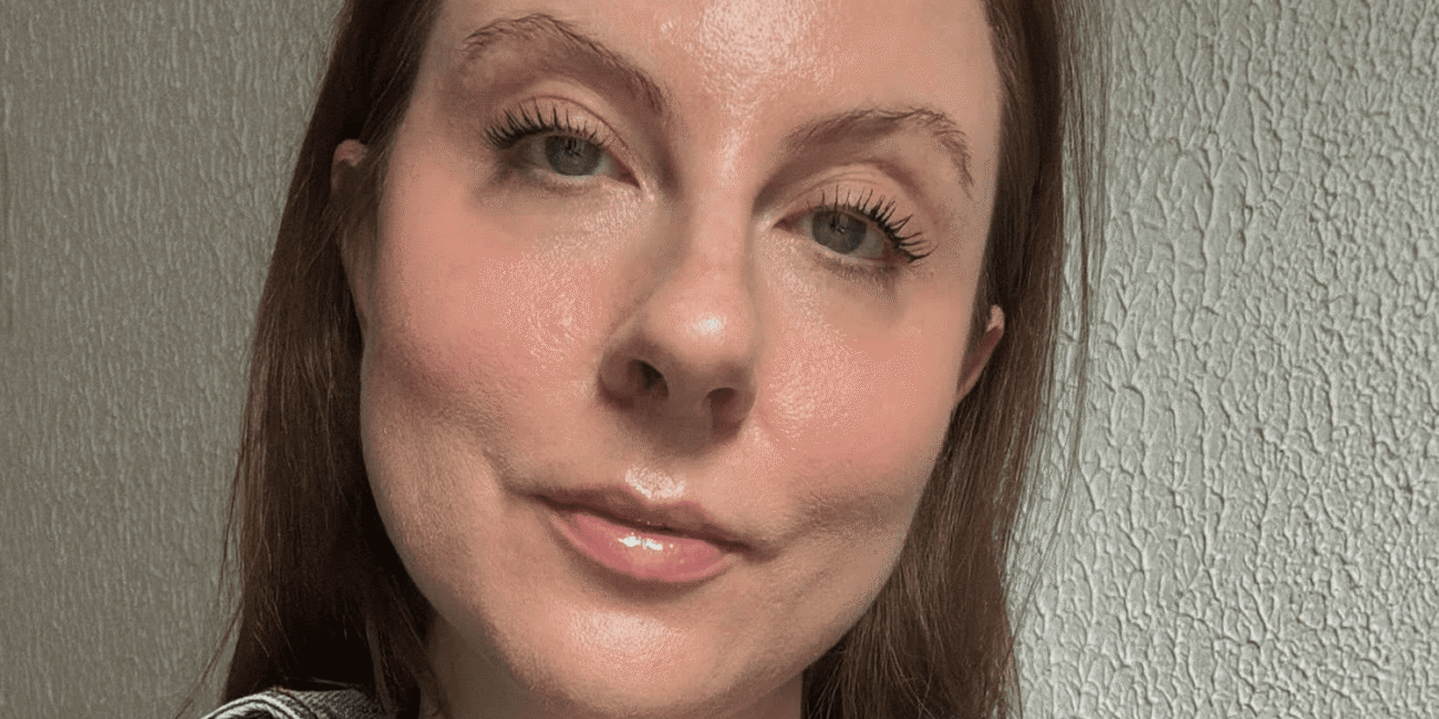 Neck Botox Review: Benefits, Cost, and More.