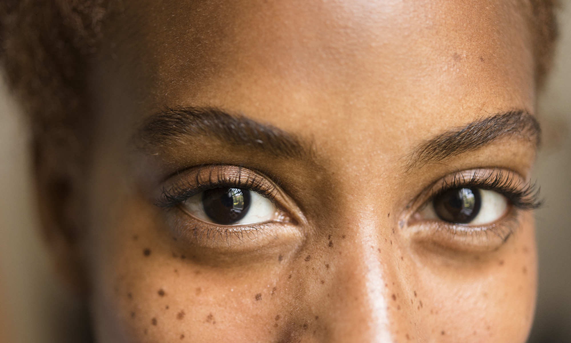 Vision Impairment May Raise Your Dementia Risk, Research Suggests