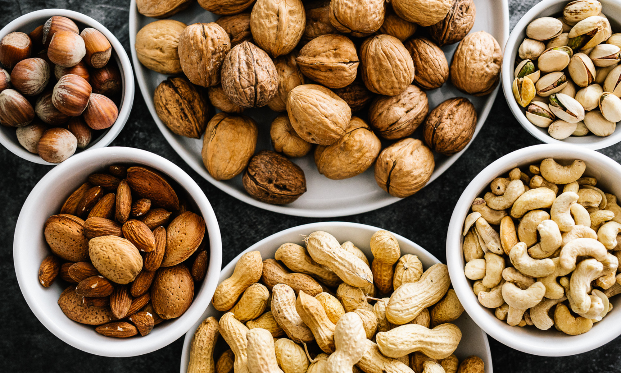 You'll Want To Eat More Of This Nut For The Sake Of Your Metabolic Health