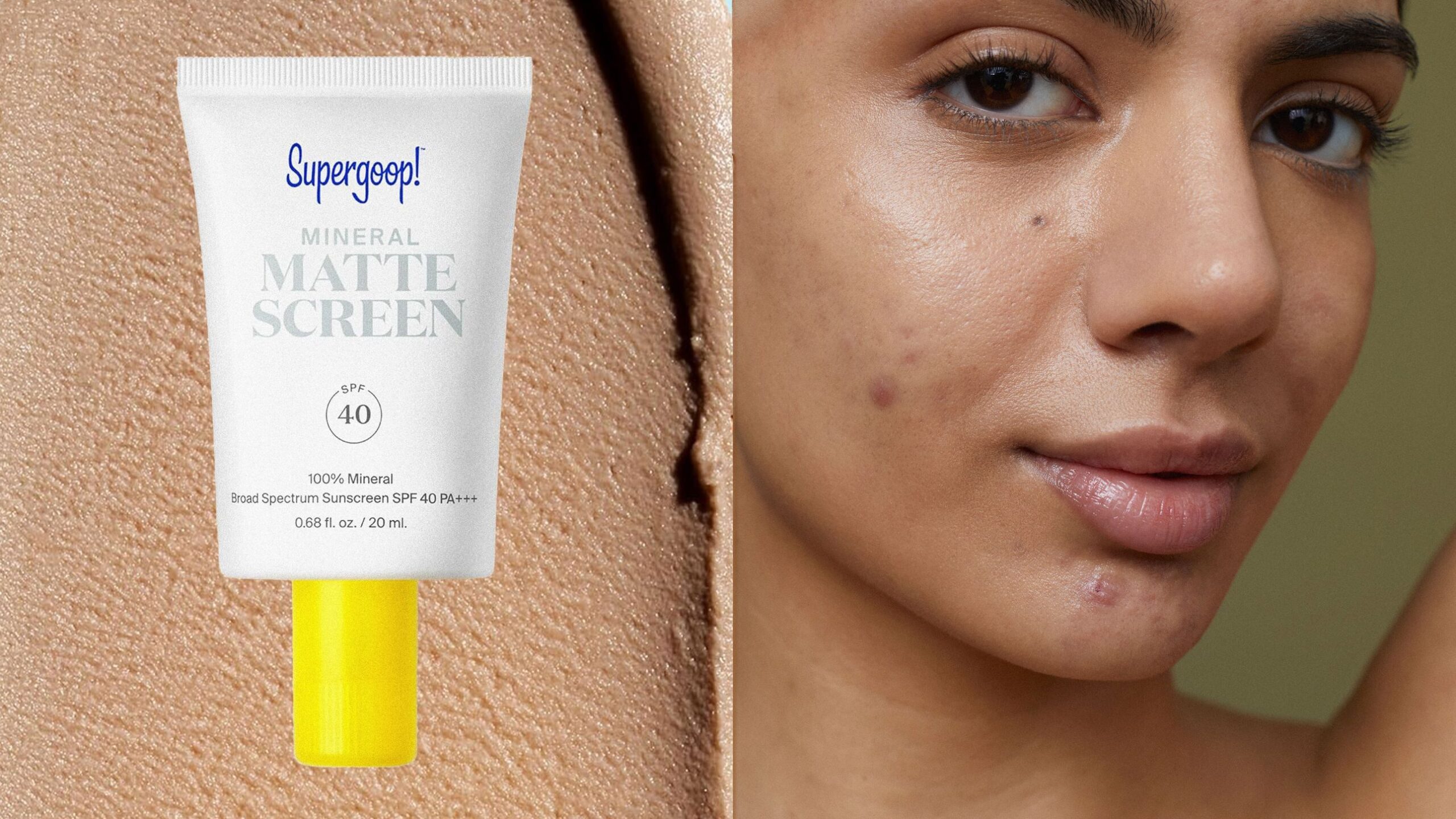 10 Best Sunscreens for Acne-Prone Skin 2025, Tested & Reviewed