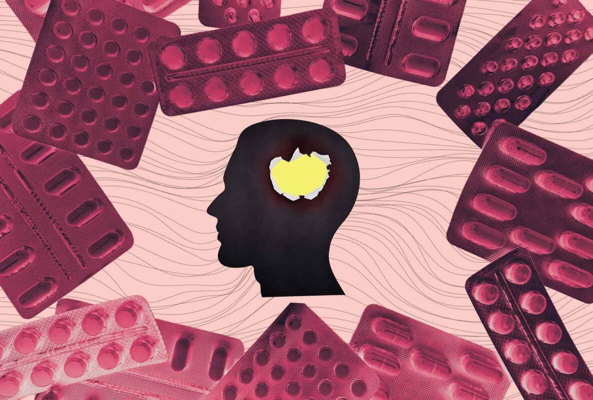 Experts' Top Supplements To Avoid for Better Brain Health