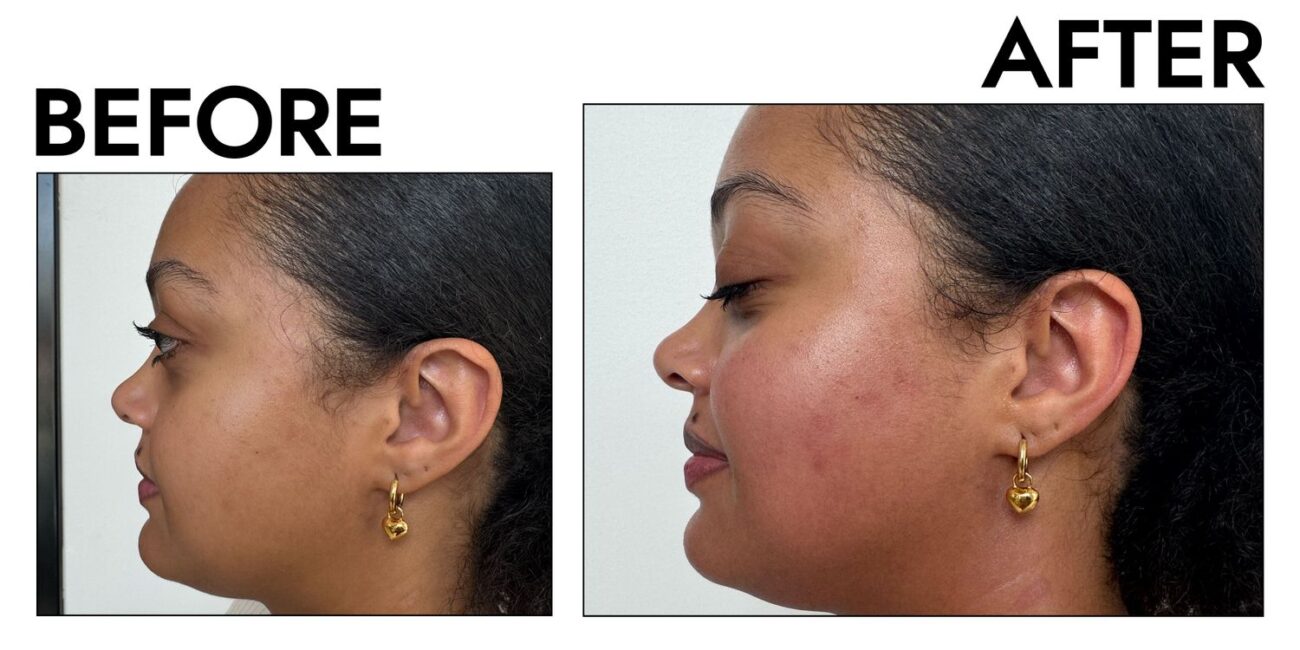 I Tried Skin Laundry’s Sculpting Facial and It’s Worth the Money