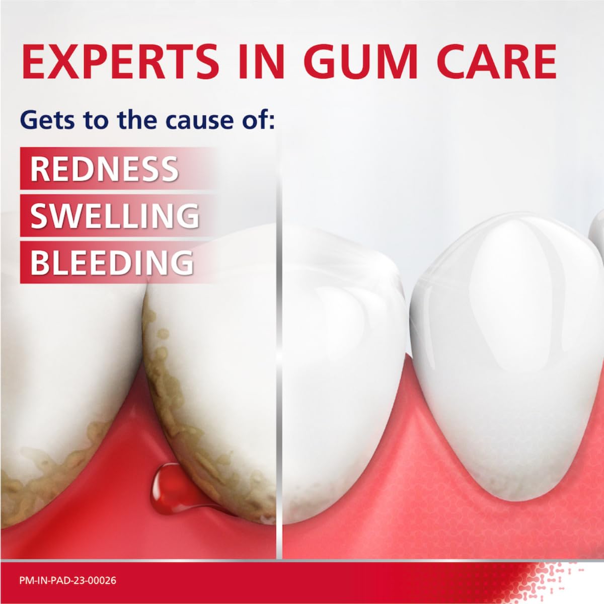 Parodontax Daily Fluoride 75g Gum Care Toothpaste For Daily Protection Against Gum Problems, Maintains Oral Hygiene With Strong Teeth And Fresh Breath (Pack of 2)