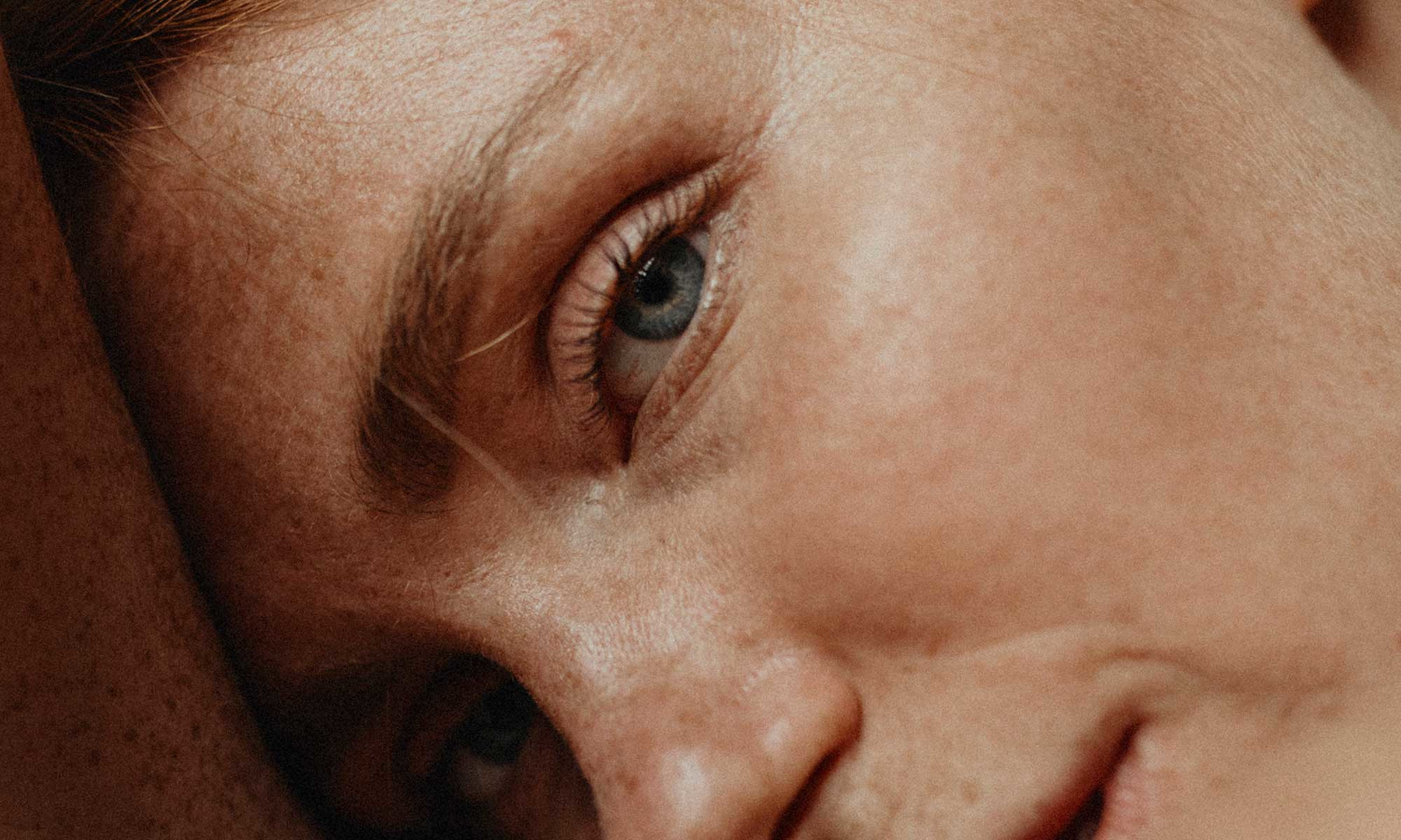 What Causes Dry Eyelids & How To Treat Them, From Derms
