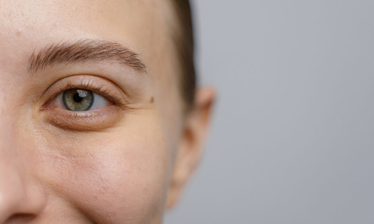 Why The Eye Area Wrinkles First & Skin Care Solutions