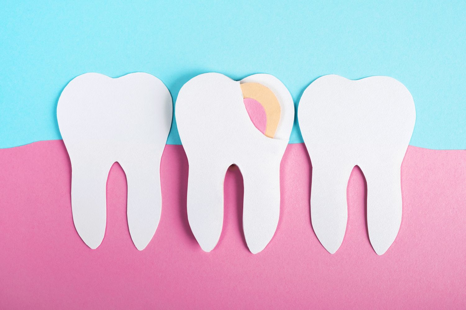 Too Much Red Meat May Worsen Gum Health