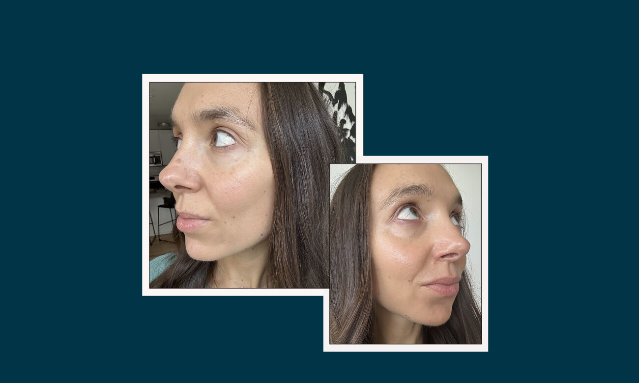 Women Of All Ages Say This Treatment Makes Their Skin Look Firm, Plump, & Youthful