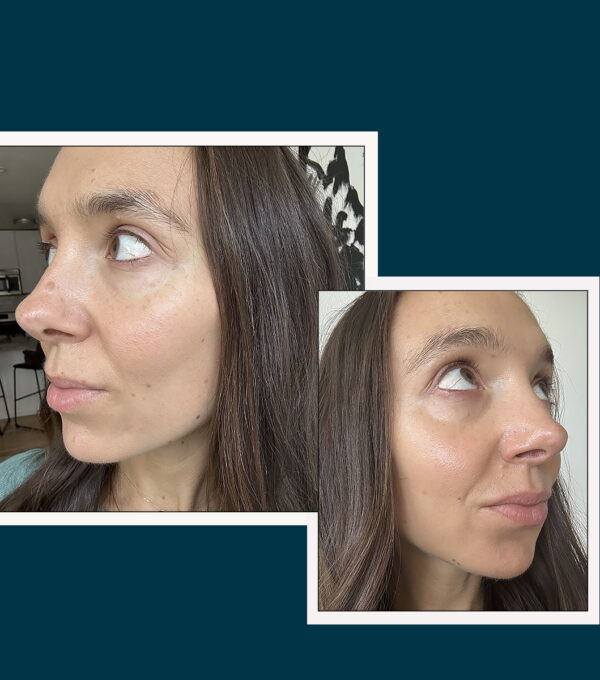 Women Of All Ages Say This Treatment Makes Their Skin Look Firm, Plump, & Youthful