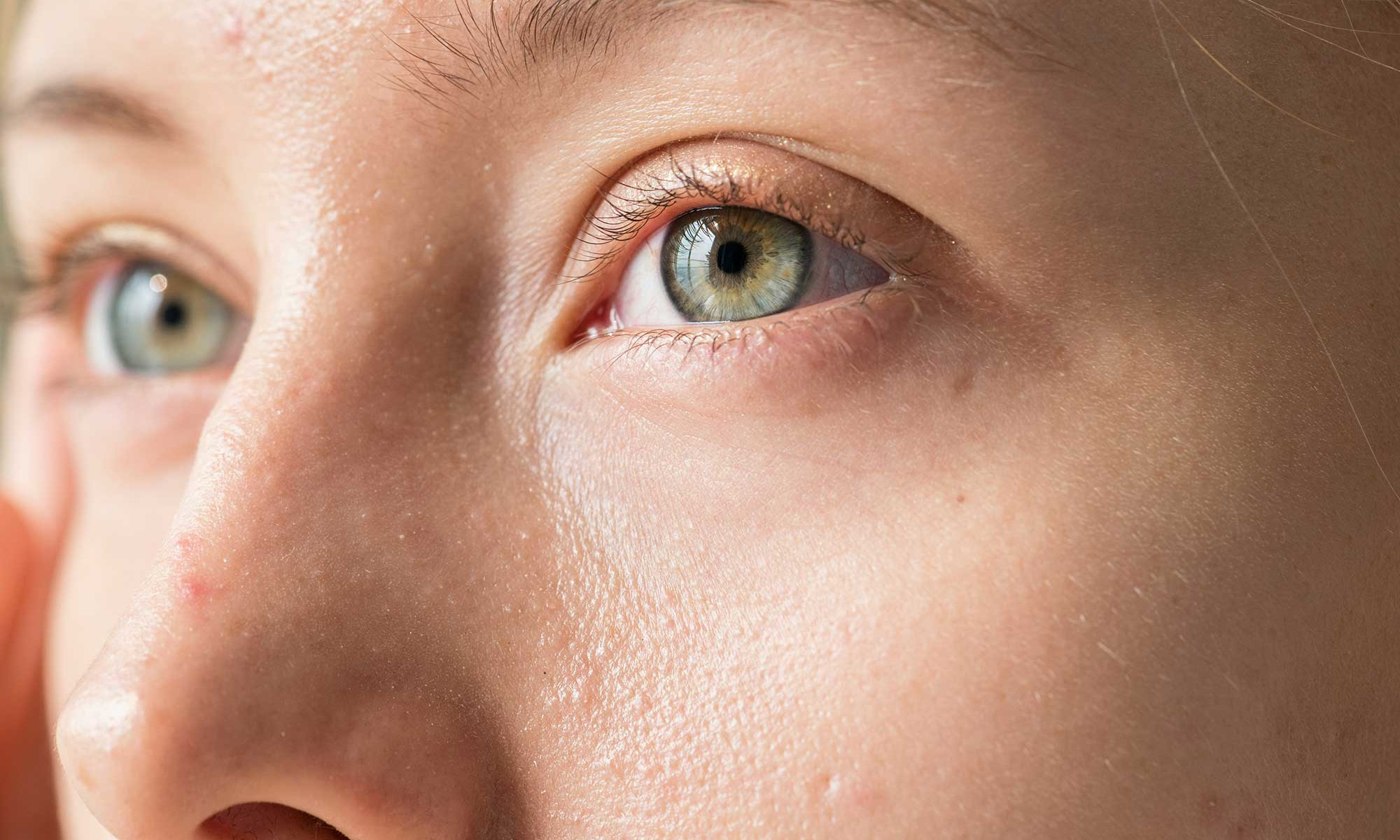 Dry Eye After LASIK or Vision Correction? What To Know